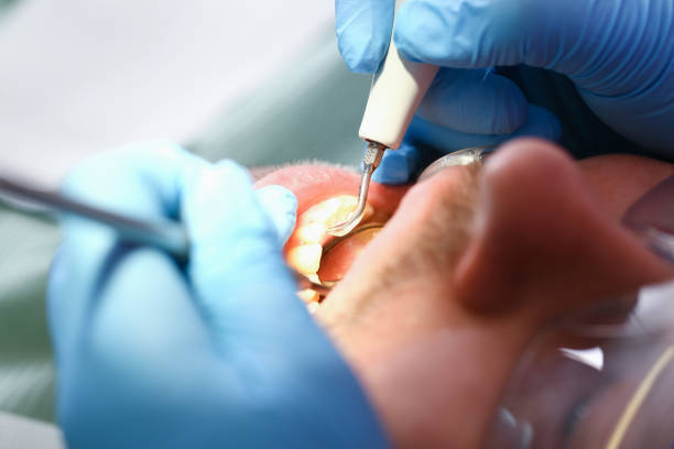 Best Teeth Whitening  in Pecos, TX